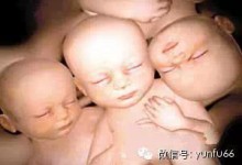好有爱啊！清晰可见多胞胎在子宫里玩耍！